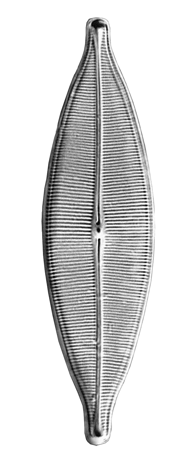 Dictyocha speculum